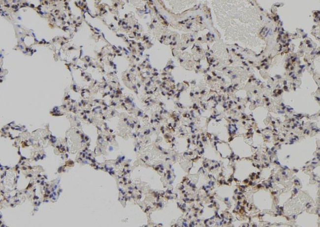 MAGED2 Antibody in Immunohistochemistry (Paraffin) (IHC (P))