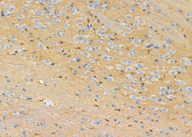 MAGEE2 Antibody in Immunohistochemistry (Paraffin) (IHC (P))