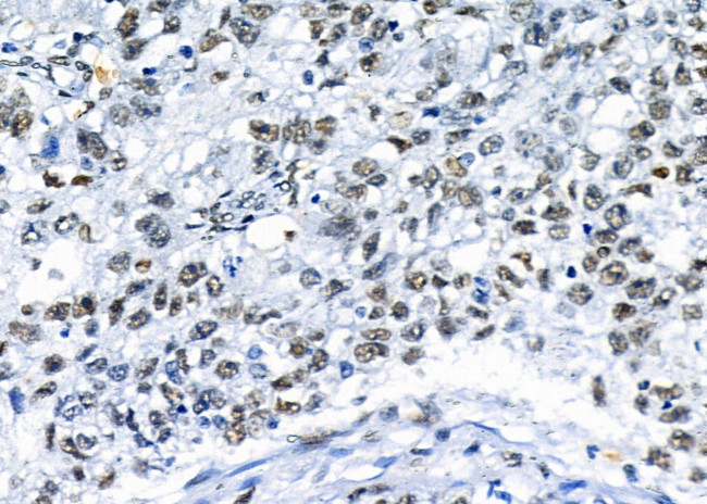 NDNL2 Antibody in Immunohistochemistry (Paraffin) (IHC (P))