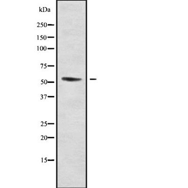 DMRTA1 Antibody in Western Blot (WB)