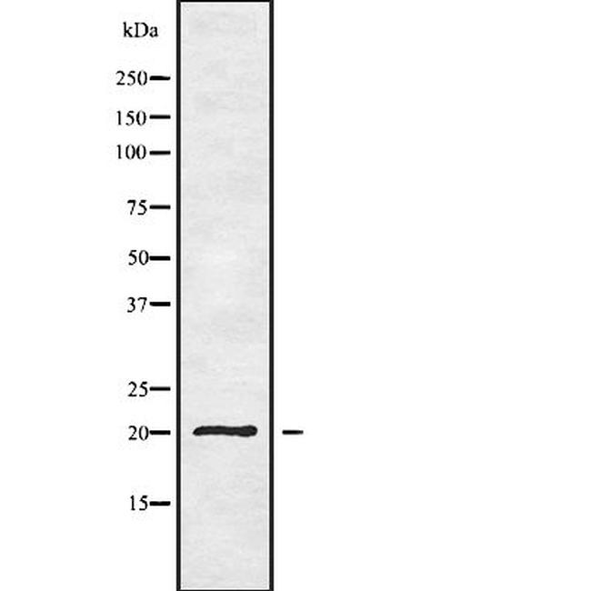YAF2 Antibody in Western Blot (WB)