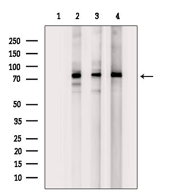 ZNF441 Antibody in Western Blot (WB)