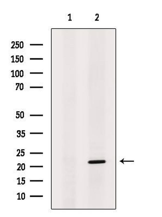 DUX5 Antibody in Western Blot (WB)