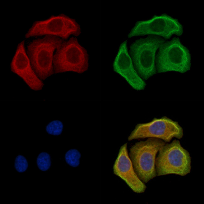 MYCBP Antibody in Immunocytochemistry (ICC/IF)