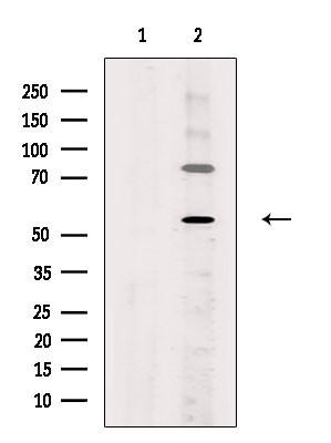 ZNF577 Antibody in Western Blot (WB)