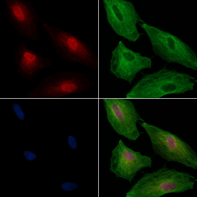 HIPK3 Antibody in Immunocytochemistry (ICC/IF)