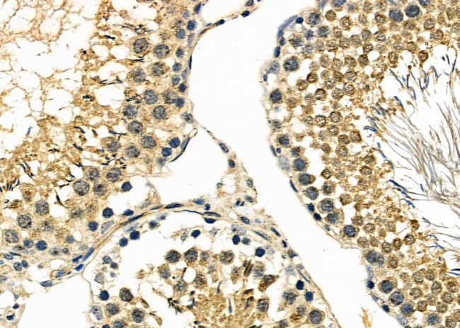 JDP2 Antibody in Immunohistochemistry (Paraffin) (IHC (P))