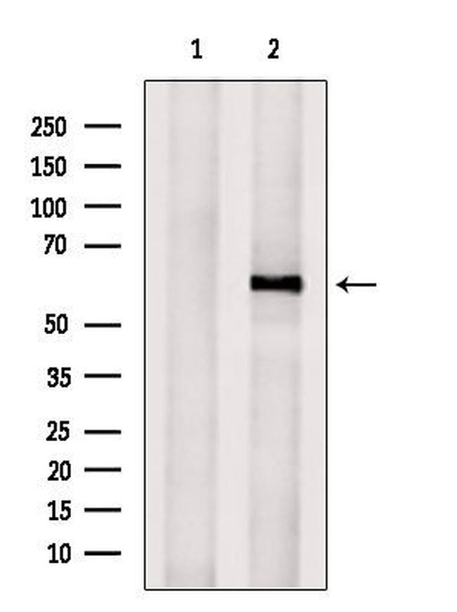CYP11B2 Antibody in Western Blot (WB)