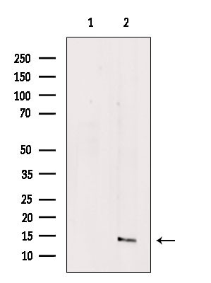 COX7A2L Antibody in Western Blot (WB)