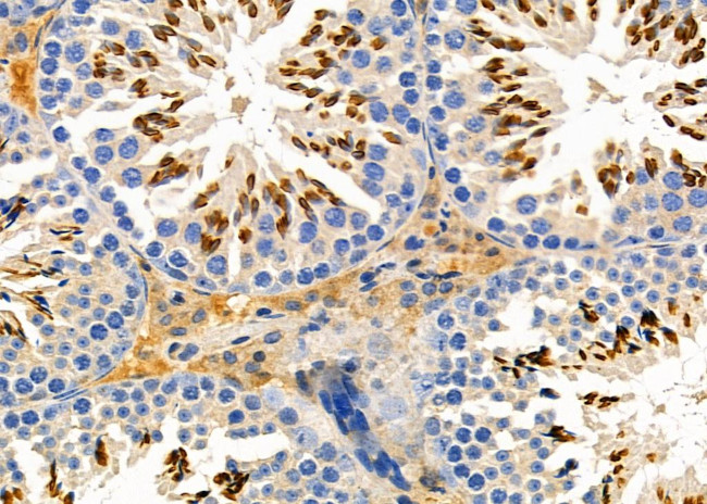 COL26A1 Antibody in Immunohistochemistry (Paraffin) (IHC (P))