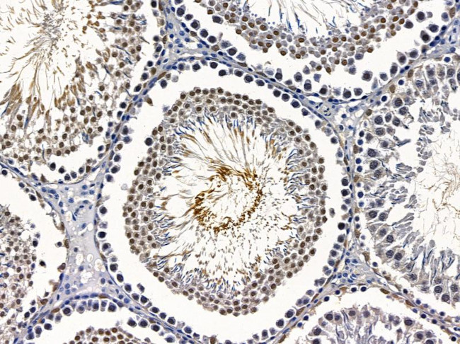 Cyclin B3 Antibody in Immunohistochemistry (Paraffin) (IHC (P))