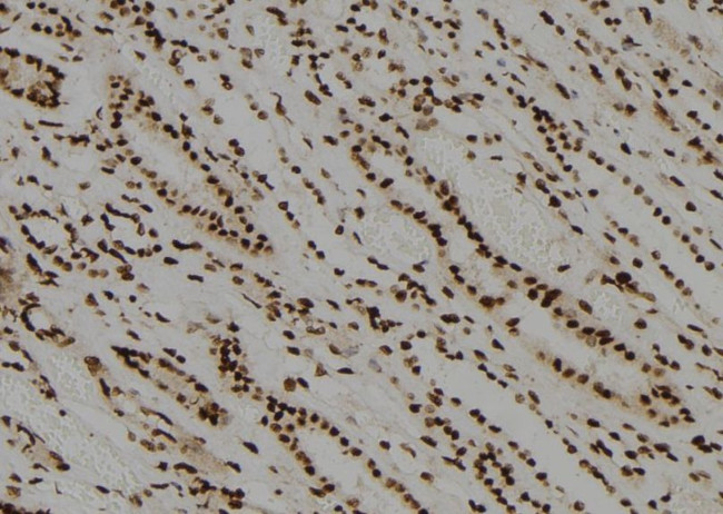 CDC14B/CDC14C Antibody in Immunohistochemistry (Paraffin) (IHC (P))