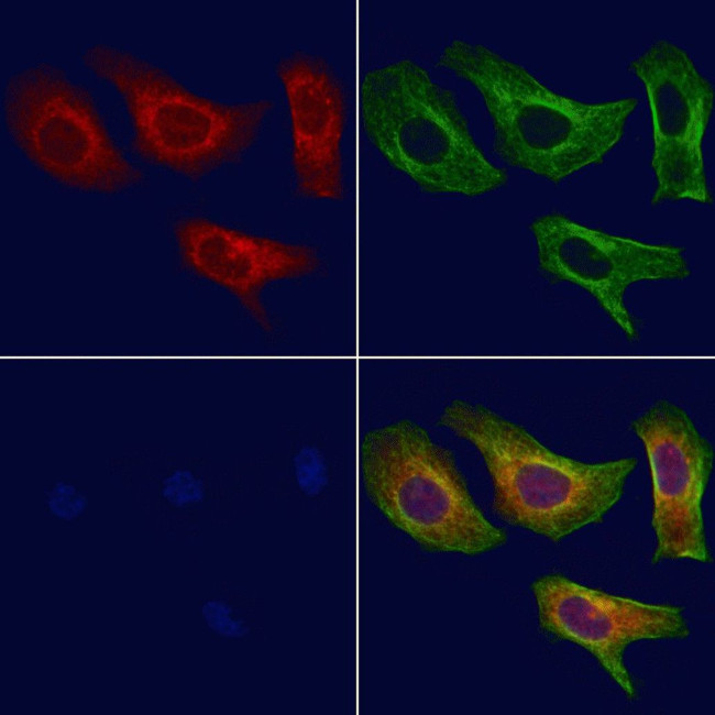 CYP4Z1/CYP4Z2P Antibody in Immunocytochemistry (ICC/IF)