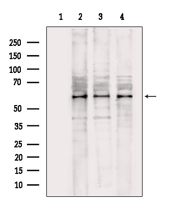 CAMKK1 Antibody in Western Blot (WB)