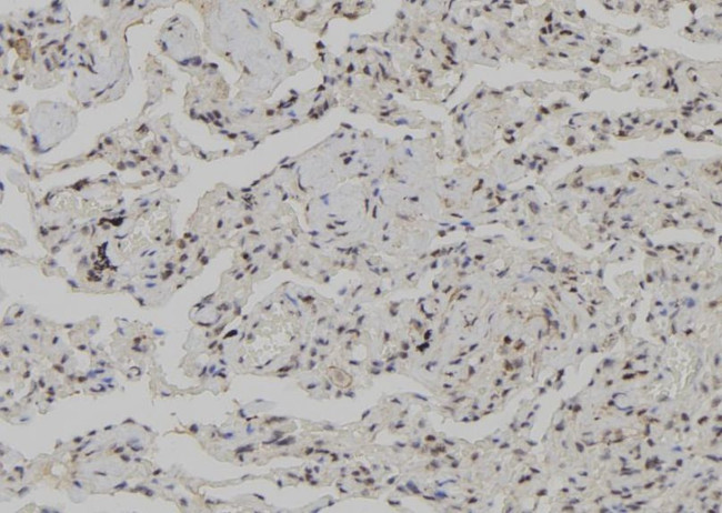 CK1 gamma-3 Antibody in Immunohistochemistry (Paraffin) (IHC (P))