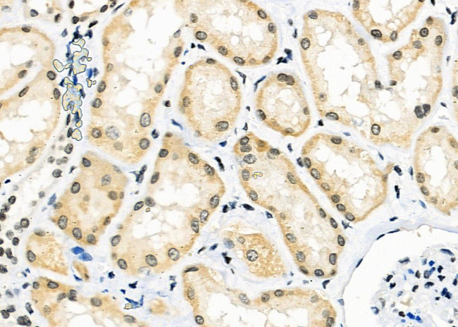 PCTAIRE2 Antibody in Immunohistochemistry (Paraffin) (IHC (P))