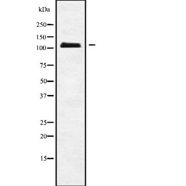 APOB48R Antibody in Western Blot (WB)