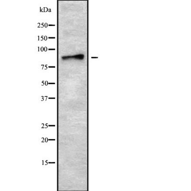 ADAM8 Antibody in Western Blot (WB)