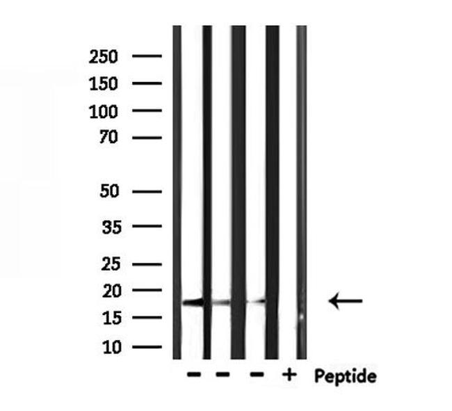 KLRC2/KLRC4 Antibody in Western Blot (WB)
