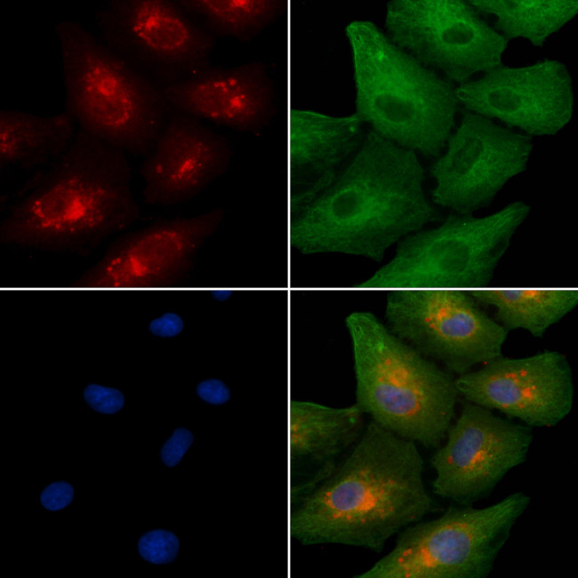 RGMB Antibody in Immunocytochemistry (ICC/IF)