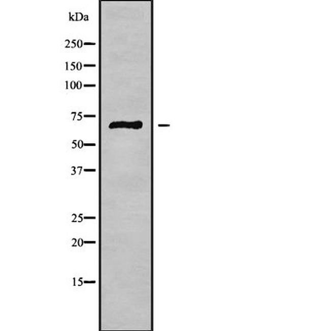 PODN Antibody in Western Blot (WB)