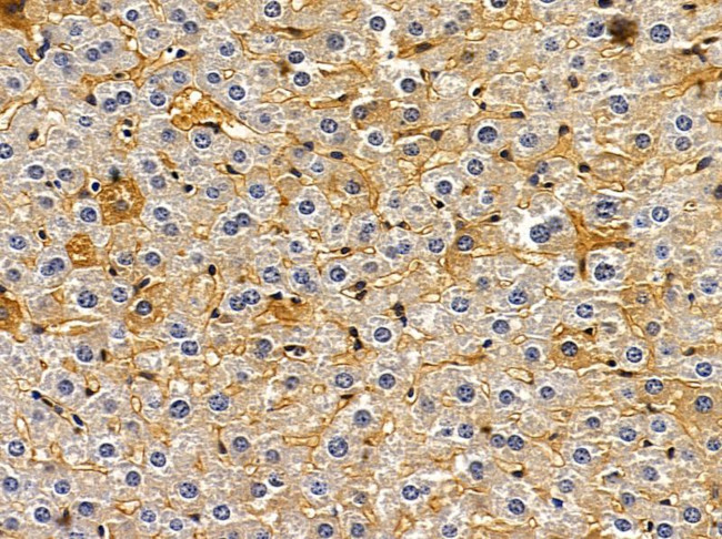 Dectin 2 Antibody in Immunohistochemistry (Paraffin) (IHC (P))