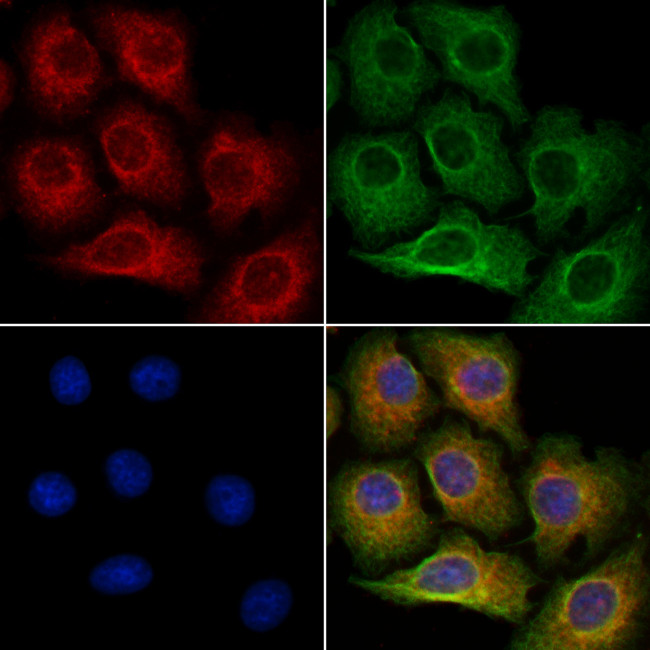 FDCSP Antibody in Immunocytochemistry (ICC/IF)