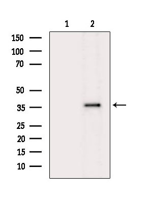 C5AR1 Antibody in Western Blot (WB)