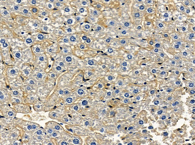 GPR112 Antibody in Immunohistochemistry (Paraffin) (IHC (P))