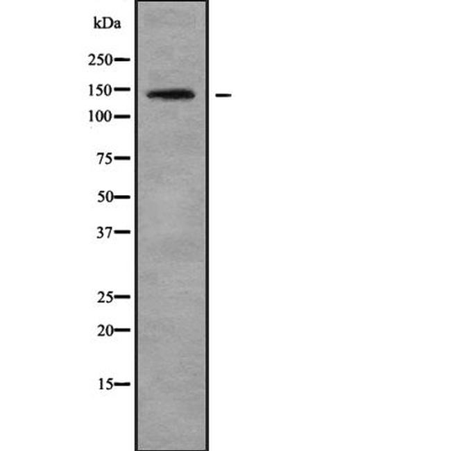 GPR125 Antibody in Western Blot (WB)