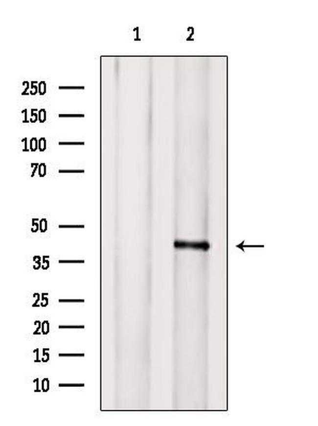 GPR85 Antibody in Western Blot (WB)