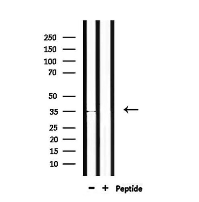 OR4C46 Antibody in Western Blot (WB)