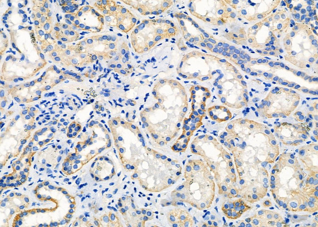 OR52B6 Antibody in Immunohistochemistry (Paraffin) (IHC (P))