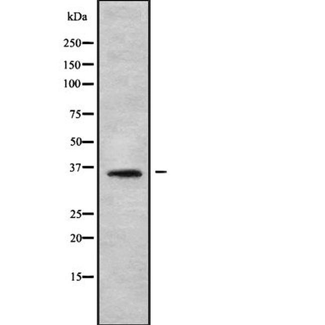 OR56B2P Antibody in Western Blot (WB)