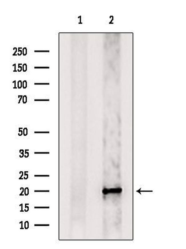 OR5AV1 Antibody in Western Blot (WB)