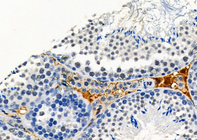OR12D2 Antibody in Immunohistochemistry (Paraffin) (IHC (P))
