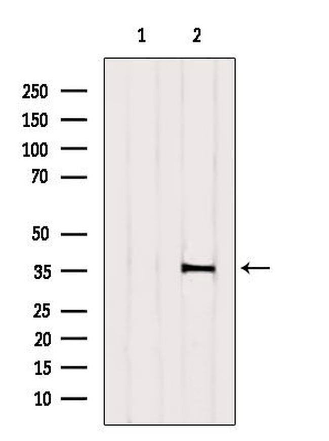 OR6B1 Antibody in Western Blot (WB)