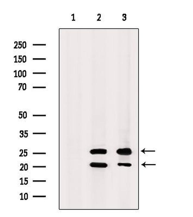 TAS2R41 Antibody in Western Blot (WB)