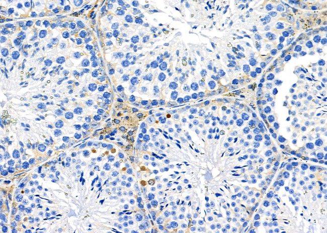 OR52M1 Antibody in Immunohistochemistry (Paraffin) (IHC (P))
