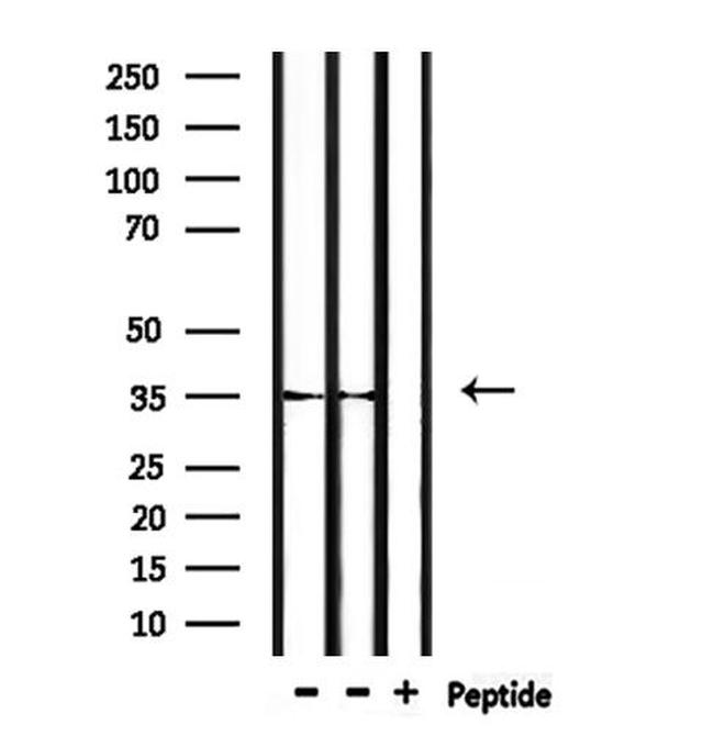 OR52P1P Antibody in Western Blot (WB)