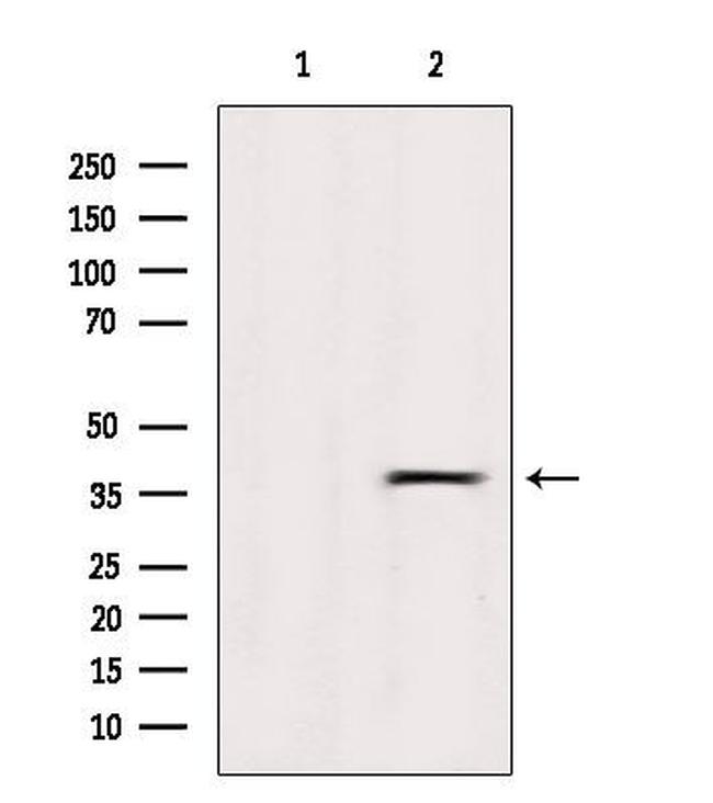 OR5R1 Antibody in Western Blot (WB)