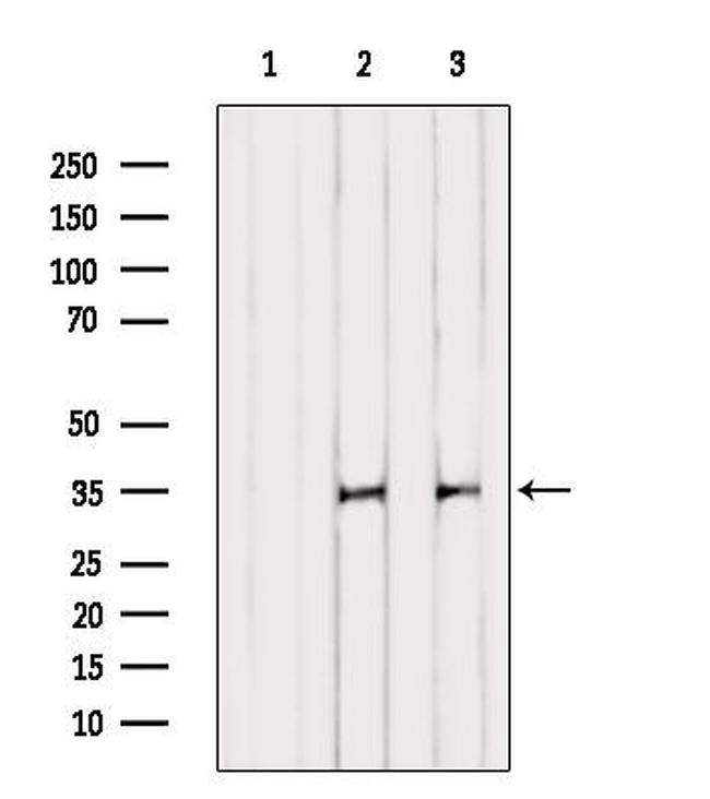 TAS2R42 Antibody in Western Blot (WB)