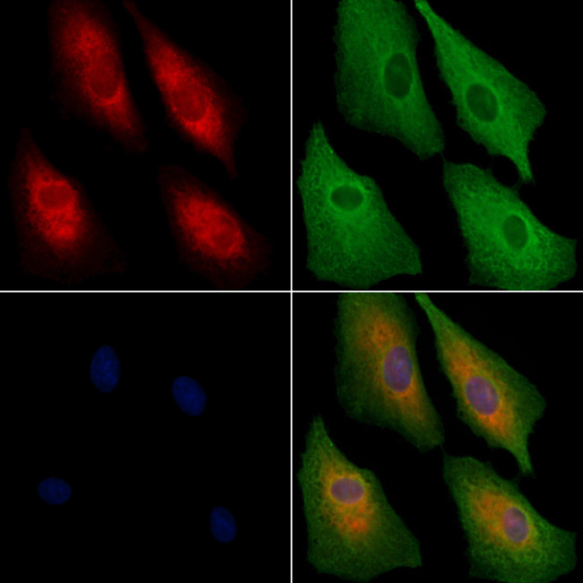U12 Antibody in Immunocytochemistry (ICC/IF)