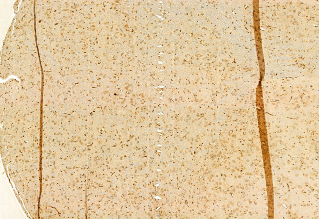 CNOT1 Antibody in Immunohistochemistry (Paraffin) (IHC (P))