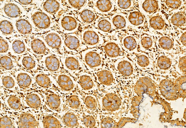 FIP200 Antibody in Immunohistochemistry (Paraffin) (IHC (P))