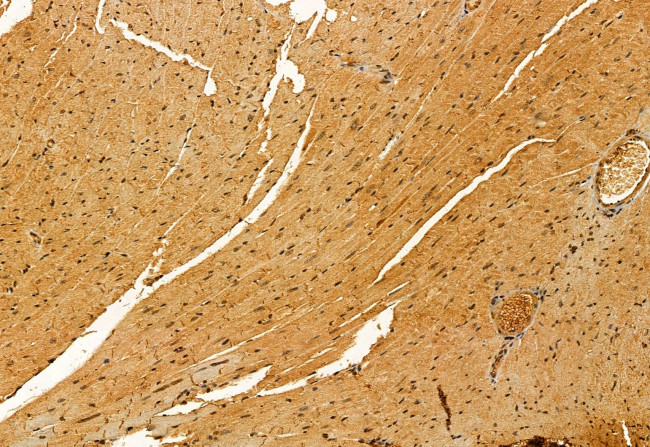 GALC Antibody in Immunohistochemistry (Paraffin) (IHC (P))