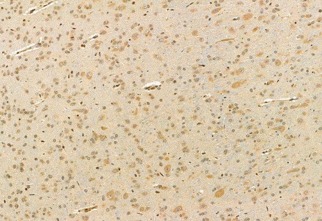 CHCHD2 Antibody in Immunohistochemistry (Paraffin) (IHC (P))