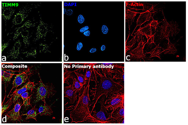 TIMM9 Antibody in Immunocytochemistry (ICC/IF)