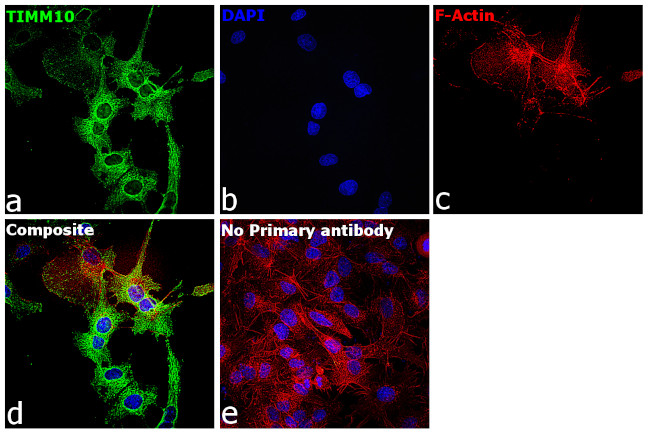 TIMM10 Antibody in Immunocytochemistry (ICC/IF)