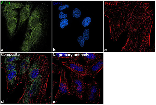 Actin Antibody in Immunocytochemistry (ICC/IF)